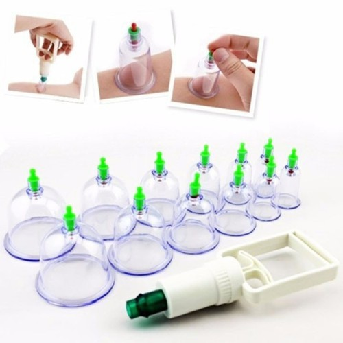 BỘ DỤNG CỤ GIÁC HƠI -KHÔNG DÙNG LỬA - 12 Ống