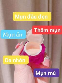 kem mụn trắng da 2C chính hãng