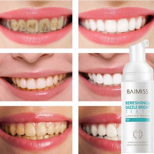 Kem đánh răng Baimiss làm sạch và trắng răng hiệu quả 60ml