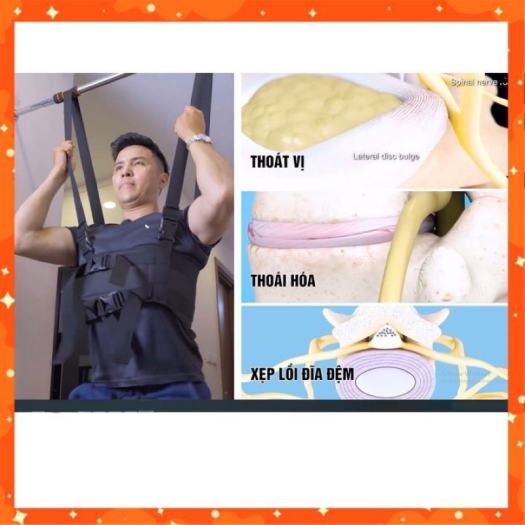 Đai Treo Kéo Giãn Cột Sống An Cốt Nam - Chỉ 5 Phút Tập Luyện Mỗi Ngày - Hiệu Quả Ngày Lần Đầu Sử Dụng