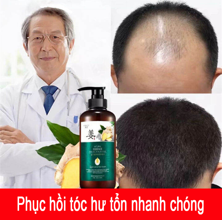 "Dầu Gội Gừng Phục Hồi Hư Tổn, Dưỡng Tóc Cho Tóc Dày, Mềm Mượt, Ngăn Ngừa Rụng Tóc, Sảng Khoái Và Không Ngứa 500ml".