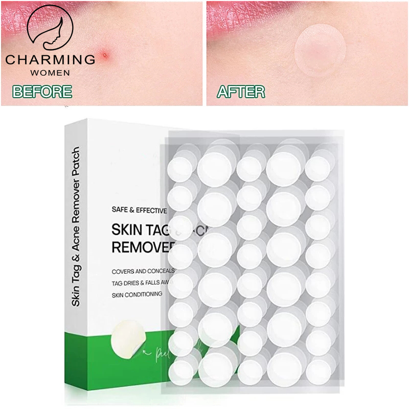 [Charming Women] 36 Cái/hộp Miếng Dán Gel Hydrocolloid Loại Bỏ Mụn Trứng Cá Miếng Dán Tẩy Da Mụn Cóc Vô Hình Dụng Cụ Làm Đẹp