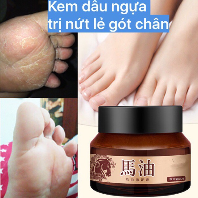 Kem dầu ngựa bôi nứt nẻ gót chân da tay hàng chất lượng