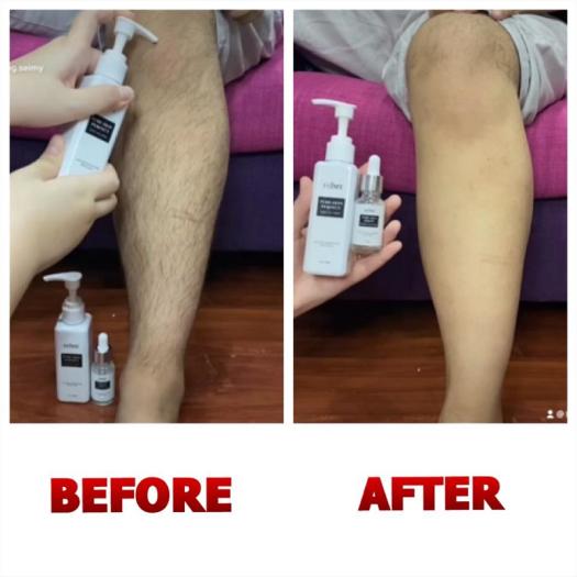 Combo Kem Tẩy Lông_ Seimy Pure Skin Perfect ( Gồm kem và serum dưỡng) Triệt Sạch Lông Chỉ Sau 5 Phút sử dụng