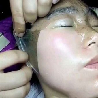 Mặt nạ màng tế bào gốc GoGo Hàn Quốc