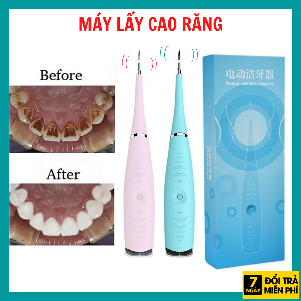 Máy lấy cao răng tại nhà sạc pin công nghệ Nhật Bản 3 chế độ rung, dụng cụ lấy cao răng cầm tay mini, máy lấy cao răng cầm tay, dụng cụ chăm sóc răng miệng loại sạch mảng bám, cao răng, vết ố răng