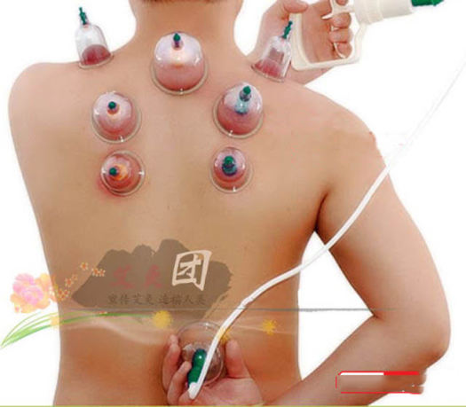 [ XẢ HÀNG ] Dụng cụ giác hơi  Cửa Hàng Bán Thiết Bị Y Tế Bộ Giác Hơi chân không - Bộ Dụng Cụ Giác Hơi 12 Ly Không Dùng Lửa Duy Thành Giác Hơi Ngay Tại Nhà Tiện Lợi