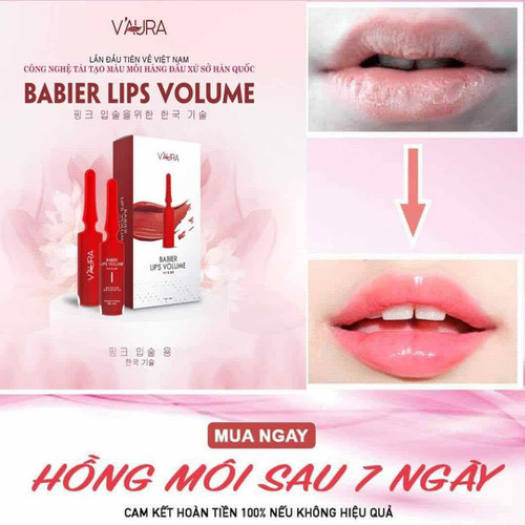 Cấy môi VAURA 2 làm hồng môi, trị thâm môi BABIER LIPS VOLUME