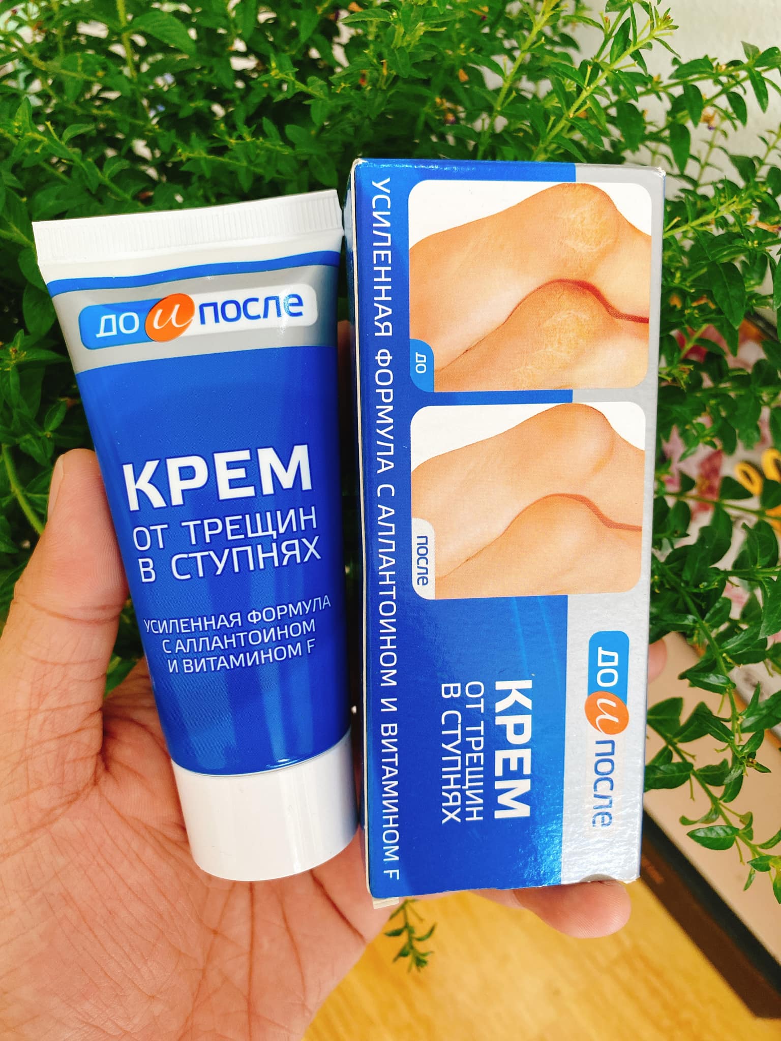 Kem giúp loại bỏ nứt gót chân kpem 50ml nga