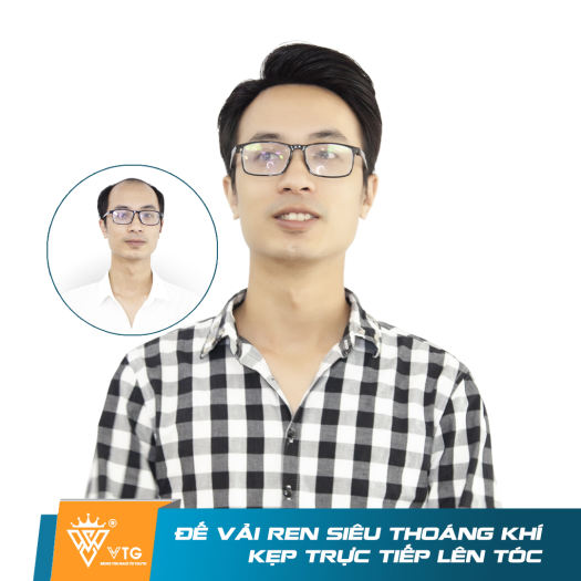 Tóc giả nam mái hói màng đôi dạng kẹp VTG D16 làm từ sợi tóc thật 100% che hói hiệu quả - Vua Tóc Giả - Tóc Giả Nam
