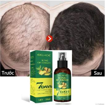 XỊT MỌC TÓC CHẮC KHỎE TỪ GỐC, TÓC KHÔNG CÒN GÃY RỤNG, THƯA MỎNG VÀ HÓI