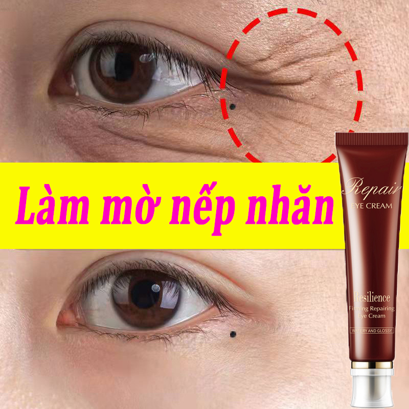 Kem mắt dưỡng mắt kem mắt chống lão hóa Loại bỏ quầng thâm mắt Kem dưỡng ẩm vùng mắt kem chống nhăn 30g loại bỏ bọng mắt nâng cơ làm săn chắc xóa mờ nếp nhăn chống lão hóa phù thũng