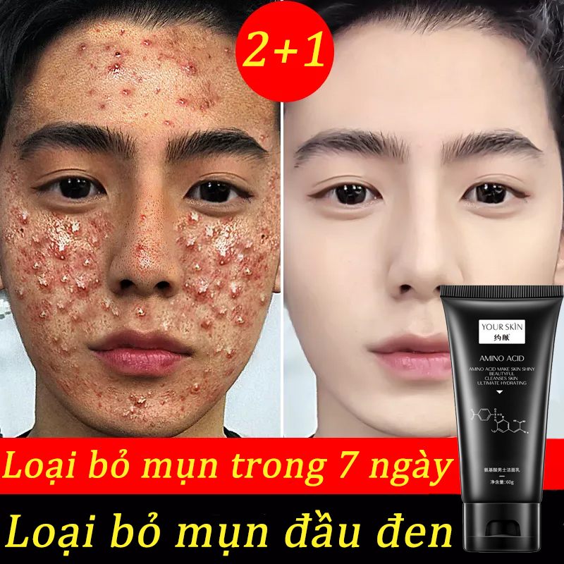 Sữa rửa mặt dành cho nam giới axit amin 60ml Kiểm soát dầu và mụn Tẩy tế bào chết,Làm sạch lỗ chân lông, dưỡng ẩm ngừa mụn Một cây để khắc phục các vấn đề về da