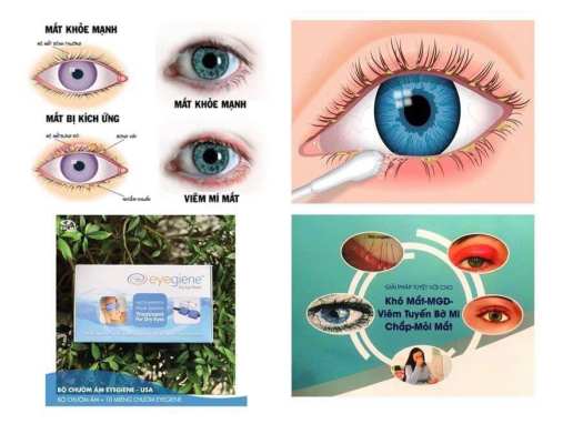 MIẾNG CHƯỜM ẤM MẮT EYEGIENE - Hỗ trợ giảm thâm mắt, che mắt giảm căng thẳng, khô mắt, đau mắt, lẹo, mỏi mắt