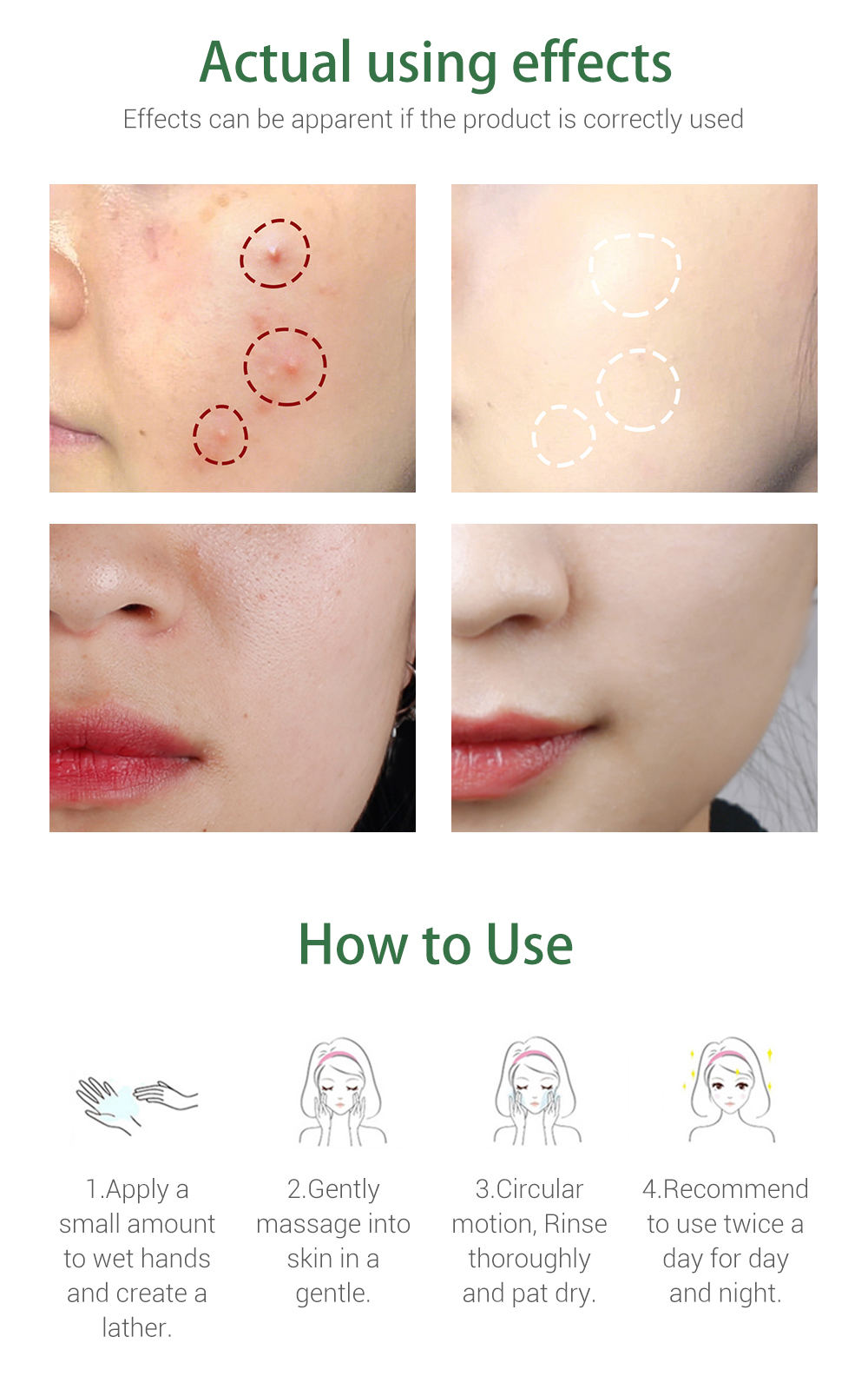 breylee acne treatment facial cleanser