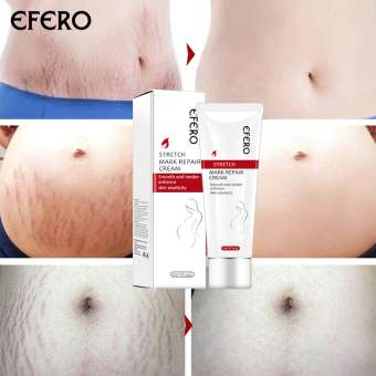EFERO Kem Trị Rạn Da Phục Hồi Da Bà Bầu Chống Nhăn Và Chống Lão Hóa Để Loại Bỏ Vết Rạn Da