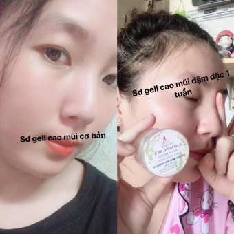GEL BÔI CAO SỐNG MŨI 100% THẢO DƯỢC THIÊN NHIÊN - LÀM CAO SỐNG MŨI TOÀN VẸN