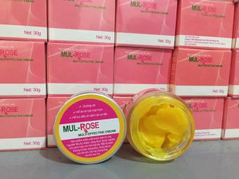 Kem bôi muỗi đốt, côn trùng cắn, vết thương, bỏng nước sôi, bỏng bô xe máy