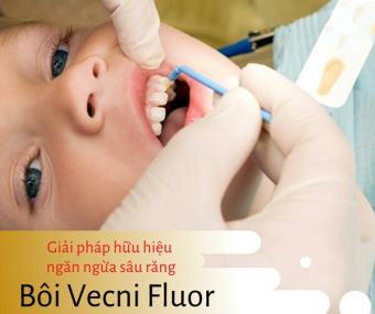 Vecni Fluor viền đỏ ENAMELAST phòng ngừa sâu sún răng