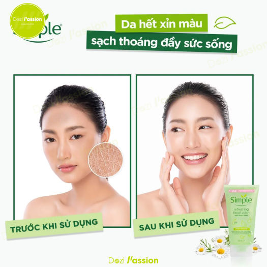 Combo Bộ Dưỡng Da Simple Cho Da Dầu, Mụn, Nhay Cảm Chính Hãng (Nước Tẩy Trang, Sữa Rửa Mặt, Toner, Kem Dưỡng)