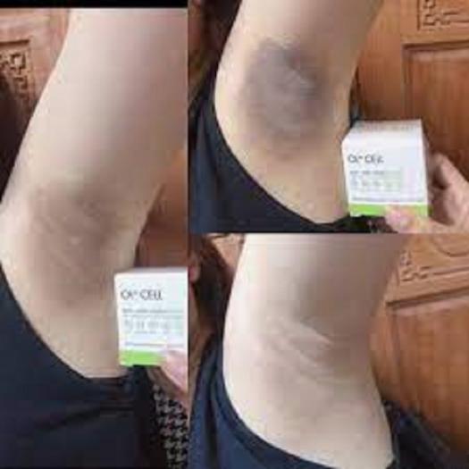 Kem trị thâm nách, thâm môi, thâm đầu gối OL-CELL