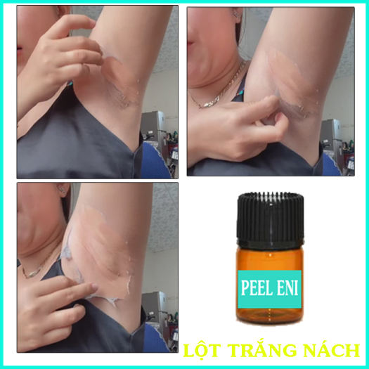 PEEL LỘT TRẮNG DA NÁCH HẾT THÂM