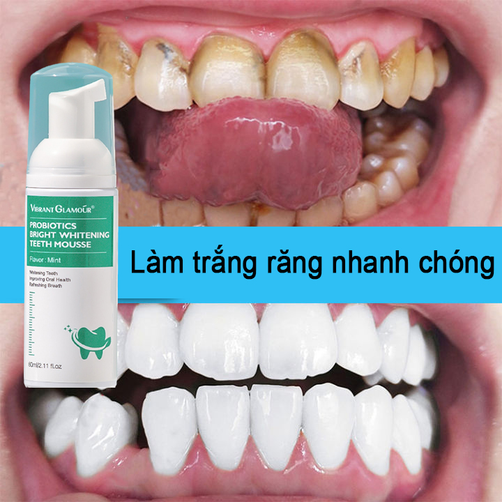 VIBRANT GLAMOR mousse làm trắng răng làm sạch răng mousse loại bỏ vết ố vàng răng làm trắng răng loại bỏ hôi miệng hơi thở thơm mát