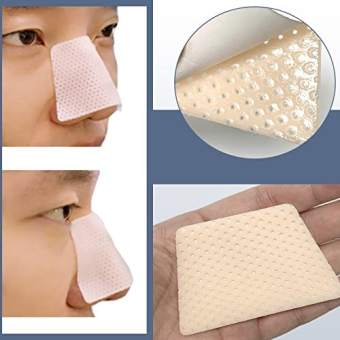 Nẹp định hình cố định sau phẫu thuật đủ size - nẹp nâng mũi - nẹp chấn thương uốn dẻo được