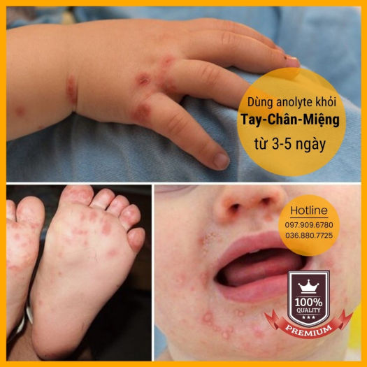 Dung dịch Anolyte KT (Nước A - Combo 3 chai 1,5lit)