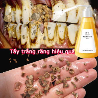 Kem đánh răng làm trắng răng Kem đánh răng loại bỏ cao răng và làm sạch răng vàng 290g Kem đánh răng làm trắng ngăn hơi thở thơm mát và mùi hôi