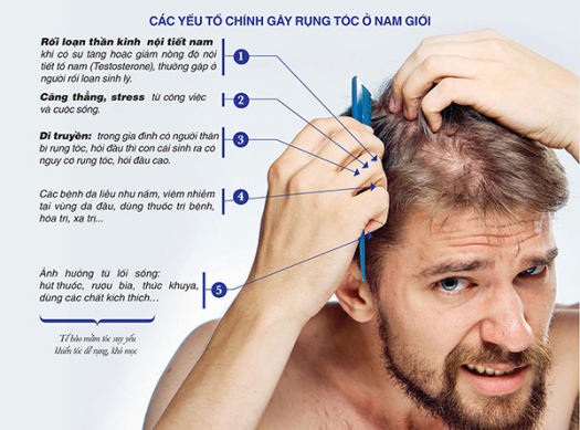 Kiểu tóc cho nam giới hói đầu che khuyết điểm hoàn hảo