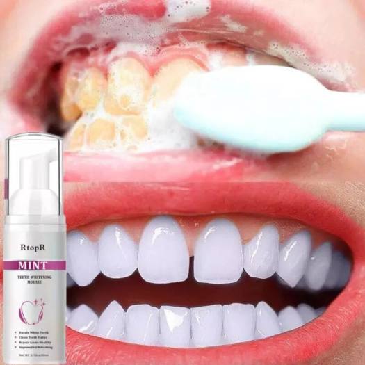 Kem RtopR Bọt Tẩy Trắng Răng Làm Sạch Răng Khử Mùi Hôi Miệng Mousse Teeth Whitening Clean Teeth 60ml
