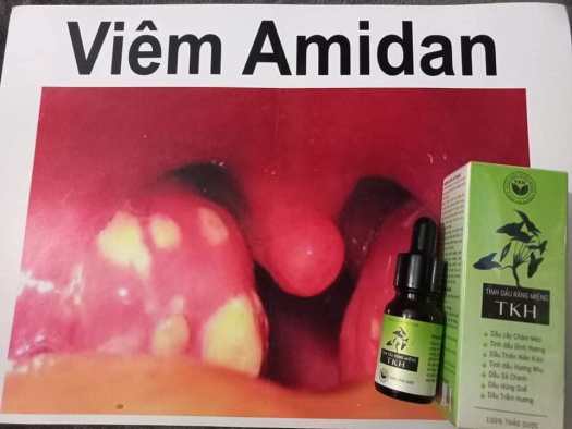 Tinh Dầu Răng Miệng TKH - Ngừa Sâu Răng Viêm Họng Ho Hiệu Quả