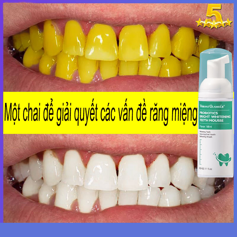 Kem đánh răng làm trắng răng Làm trắng răng Nước súc miệng hiệu quả cao Nước súc miệng làm trắng chuyên nghiệp Làm trắng nhanh chuyên nghiệp Làm sạch miệng Loại bỏ mảng bám Làm trắng răng Chống hôi miệng Chống sâu răng 60ml