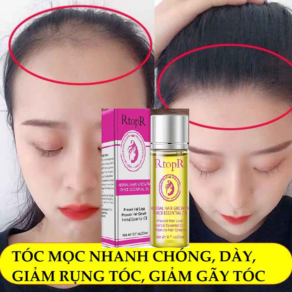 Tinh chất Mọc Tóc Herbal Hair Kích Thích Mọc Tóc Nhanh Chóng Giảm Rụng Tóc Nuôi Dưỡng Tóc Bồng Bềnh Suôn Mượt Tự Nhiên