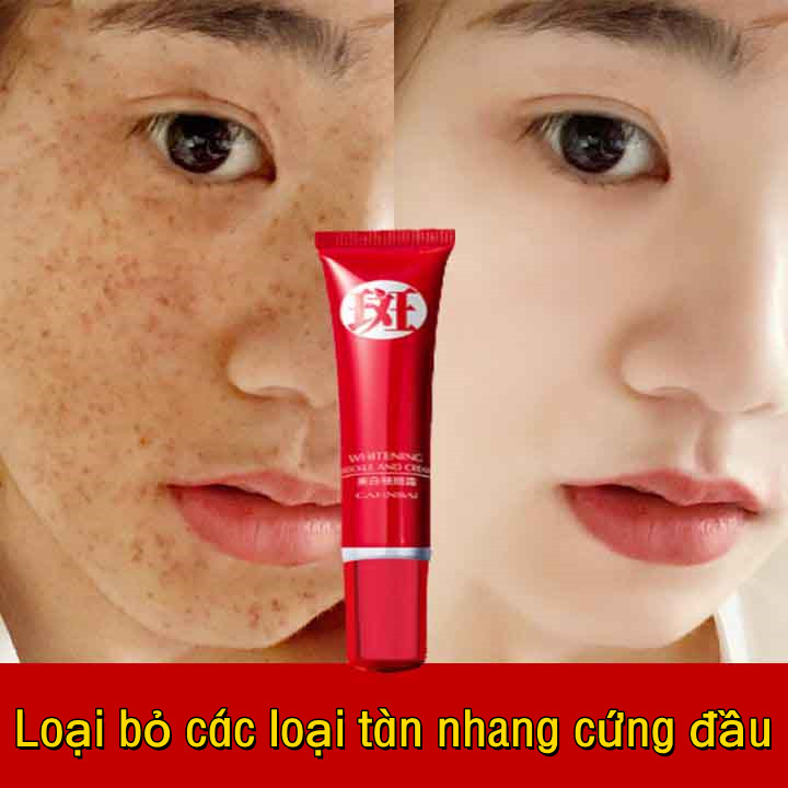 Kem  tiêu diệt tàn nhang [loại bỏ tàn nhang nhanh chóng] Làm trắng da và loại bỏ tàn nhang hiệu quả Dưỡng ẩm da mặt  làm trắng da ,sản phẩm che mờ  tàn nhang  loại bỏ sẹo  chăm sóc da