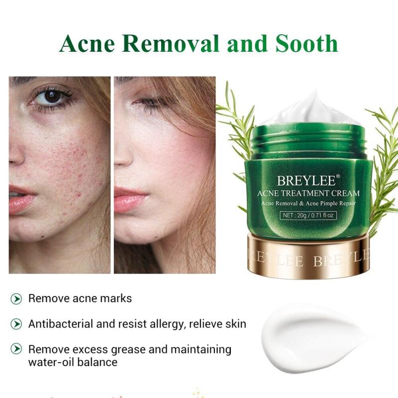 Serum BREYLEE Acne Treatment Kit Mụn Chăm Sóc Da Mặt Kem Dưỡng Da Mặt Skincare Mụn ẩn Chấm Mụn Serum Dưỡng Da Dàm Trắng 17ml