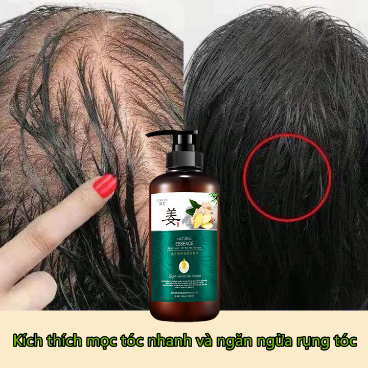 Dầu gội mọc tóc gừng, dầu gội gừng bổ dưỡng, chiết xuất thực vật, giúp tóc chắc chắn, kích thích mọc tóc, ngăn rụng tóc 500ml