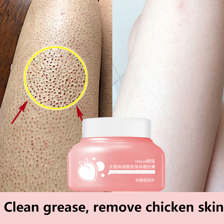Gambar ?Special offer price?Exfoliating Scrub 250g body whitening clean grease exfoliate chicken skin Improve rough and dull skin Brighten skin colour smooth skin body  Scrub