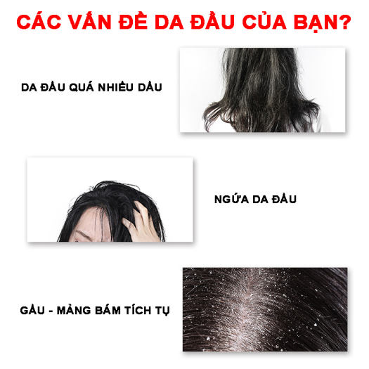 Tẩy da chết cho tóc và da đầu JIORNIEE Hana Tech hũ 250ml - Sạch Gàu, Kiềm Soát Dầu Thừa, Tóc Không Còn Bết Dính - Tẩy tế bào chết da đầu, tẩy tế bào chết tóc, tẩy da chết đầu, tẩy tế bào chết cho da đầu - Hanatech