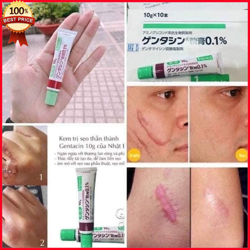 Kem sẹo gentacin nhật bản tuýp 10g - kem liền sẹo lâu năm - trâu beauty