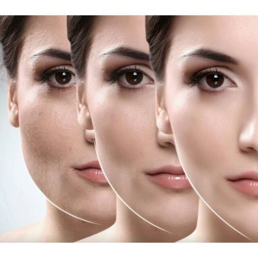 Kem xoa Thon Gọn Tạo Mặt V-Line Giảm Nọng Cằm