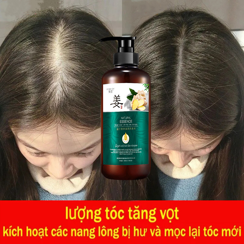 Dầu gội ngăn ngừa rụng tóc chiết xuất từ gừng tươi 500ml. Dầu gội ngăn ngừa rụng tóc chăm sóc tóc, sản phẩm chăm sóc ngăn ngừa rụng tóc,dầu gội mọc tóc