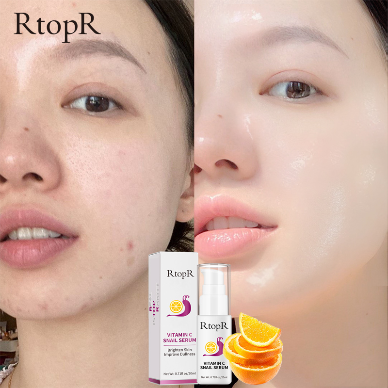 Serum RtopR Vitamin C Snail giúp làm săn chắc và trẻ hoá làn da - INTL