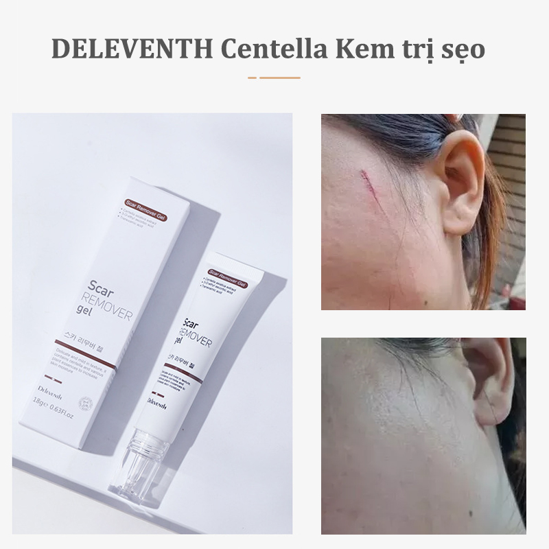 DELEVENTH Centella Kem Làm Mờ Sẹo Giảm sẹo và vết rạn da Làm sáng màu da