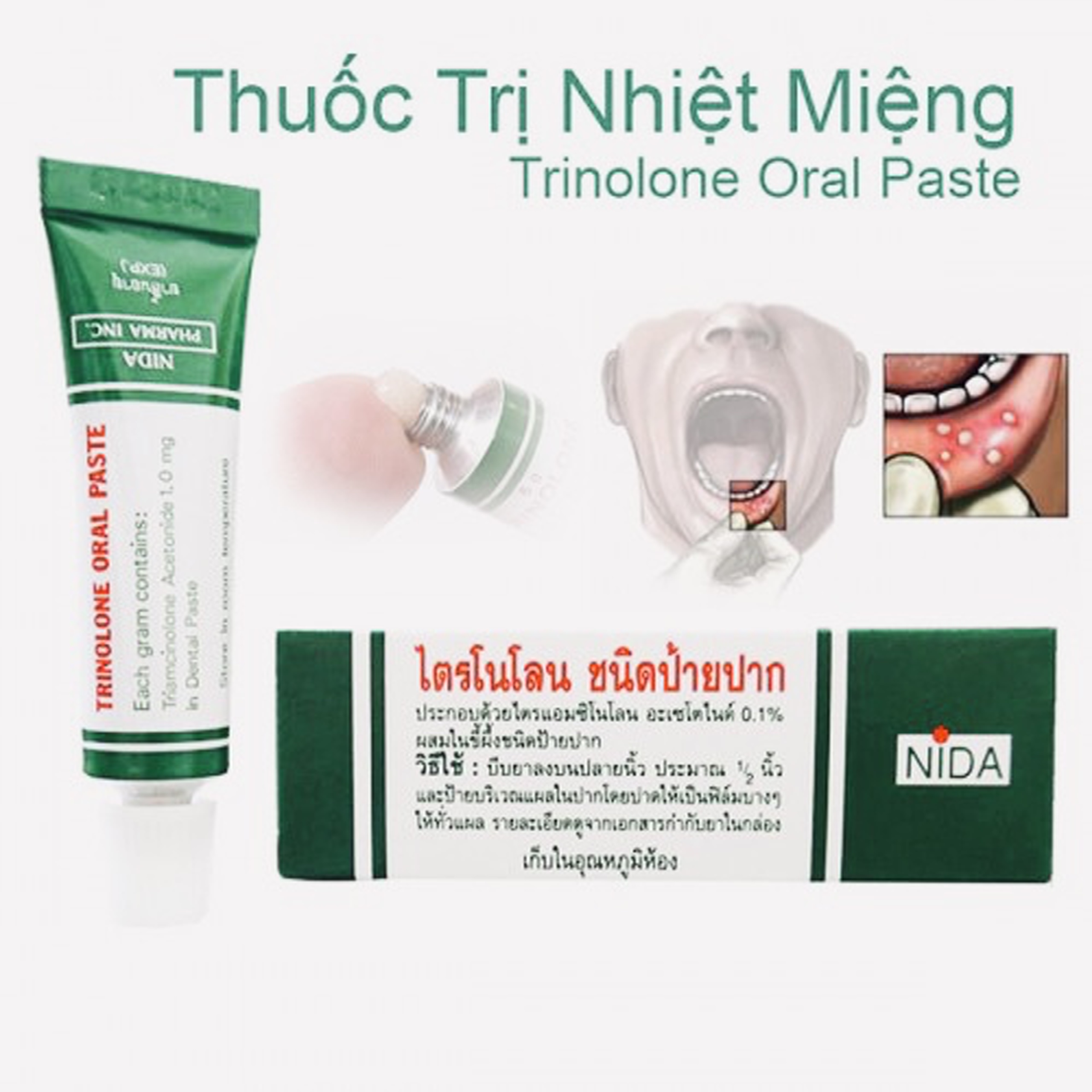 [HCM]Kem thoa nhiệt miệng Trinolone Oral Paste THÁI LAN