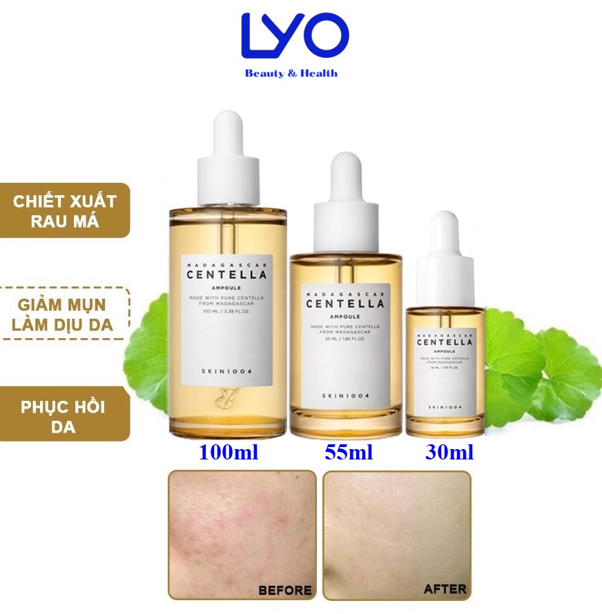 Tinh chất rau má skin1004 madagascar centella ampoule 55ml - 100ml