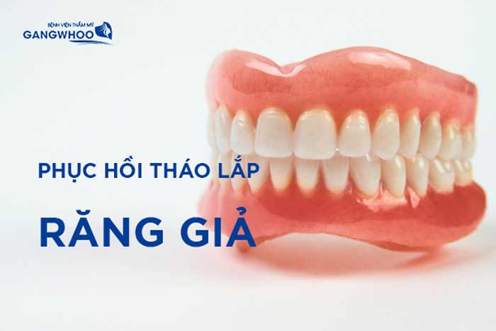 PHỤC HỒI THÁO LẮP ( RĂNG GIẢ): Răng composite