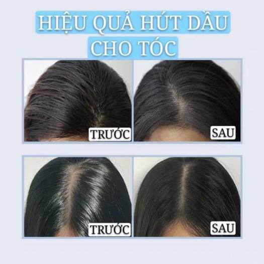 Dầu Gội Khô ISSY Xịt Tóc Khô Kiwi, Hết Bết, Dầu Gội Khô Giúp Mang Lại Độ Tơi Phồng Cho Tóc -  Bình Xịt Gội Tóc Khô Không Cần Nước, Hàng Nội Địa Trung, Đủ 4 Mùi Hương - Màu Xanh- Tặng  Mặt Nạ Dưỡng Môi