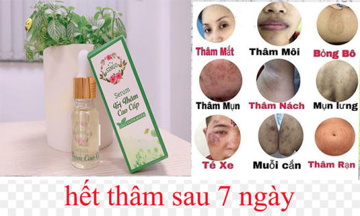 Serum trị thâm Singo cao cấp